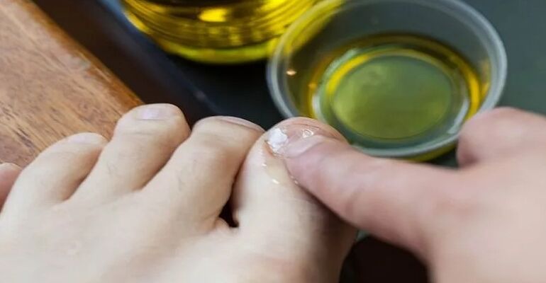 Essential oils fight fungi