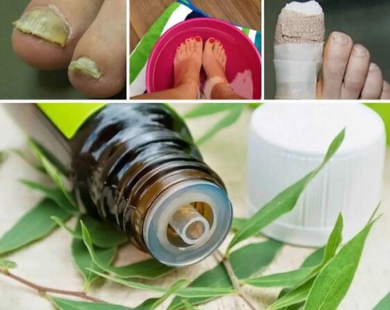tea tree