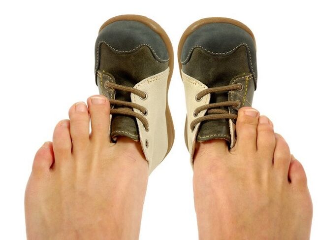 Shoes that are too tight can cause mildew between the toes
