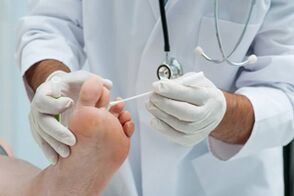 Before treatment, a doctor diagnoses onychomycosis
