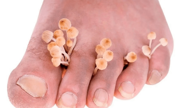 Skin fungi