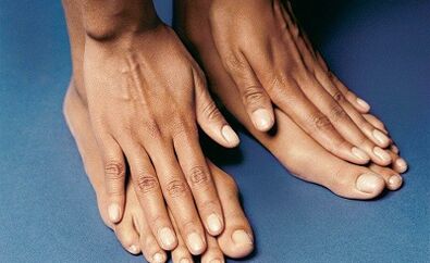 How to treat fungi on your fingers