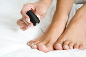 Nail polish to treat foot fungus